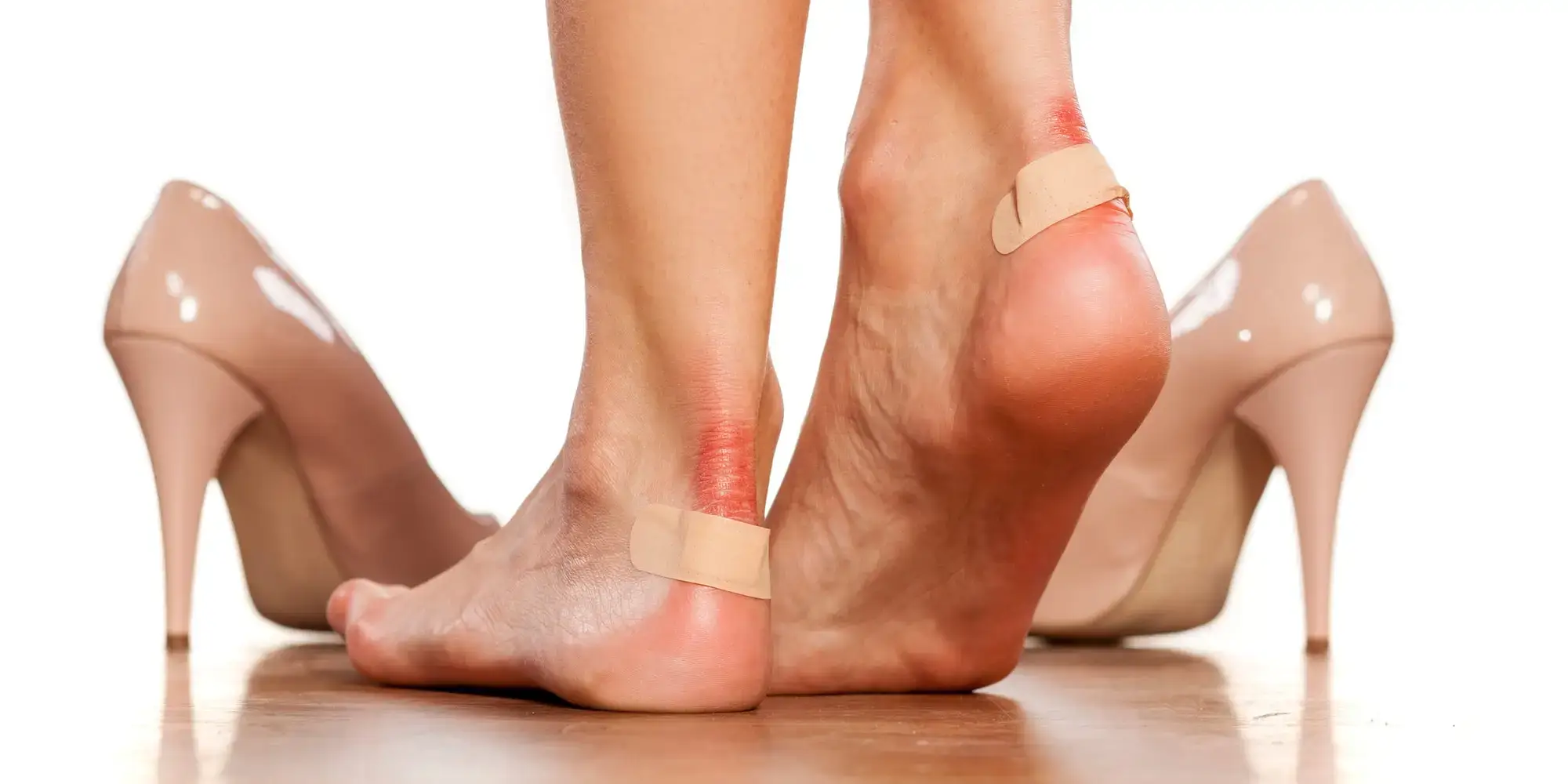 How to Heal Blisters on Feet Overnight